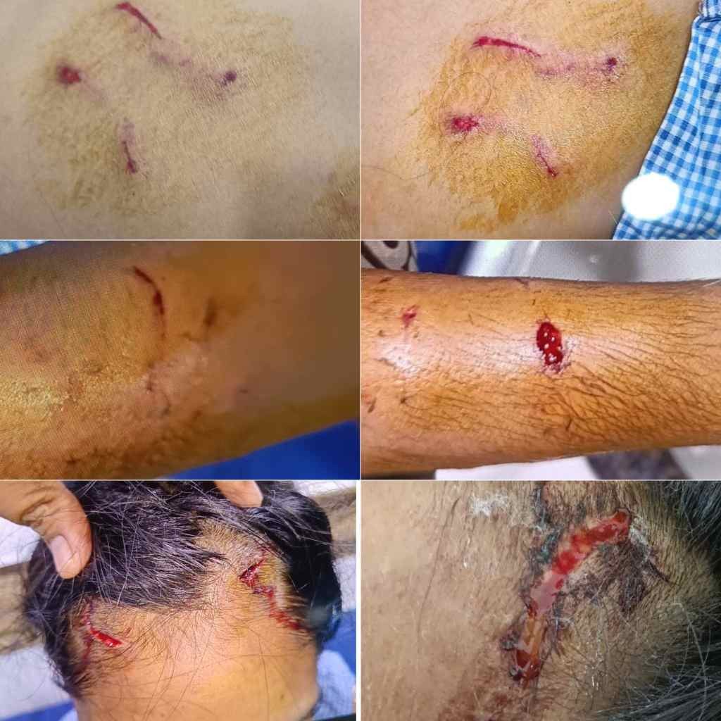 Generic placeholder image